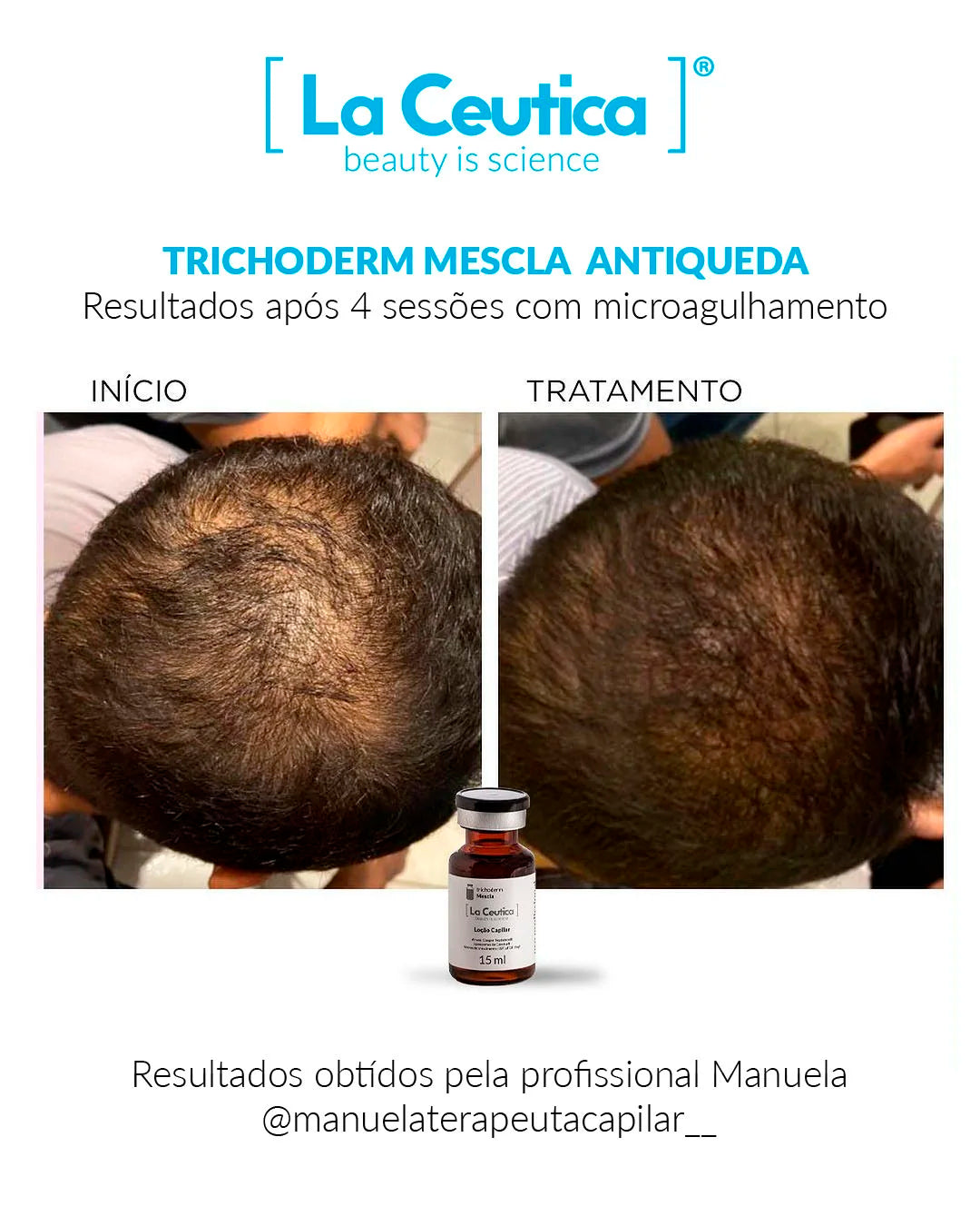 Trichoderm Mescla Antiqueda – 3 ampolas de 7 ml